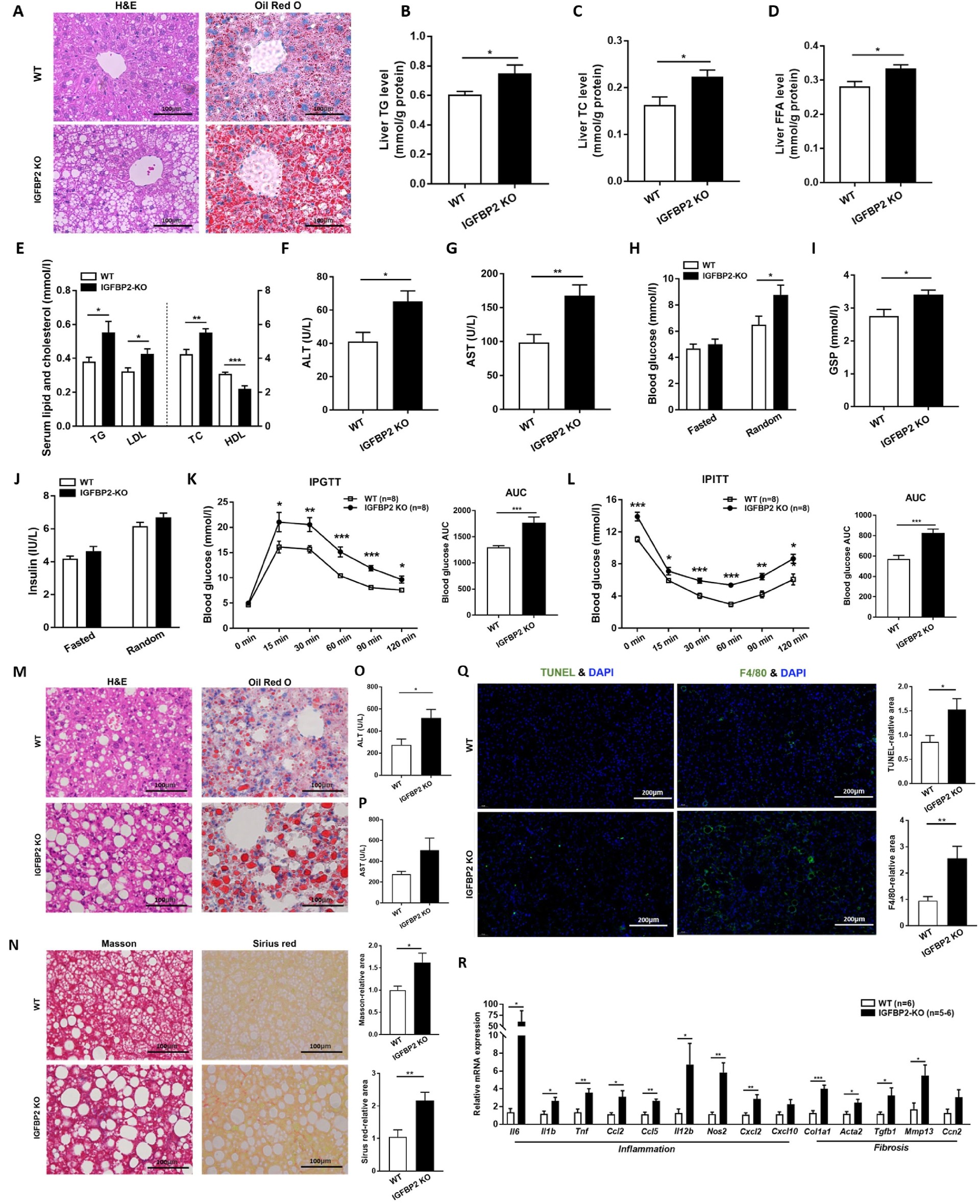 图 2：IGFBP2 缺失加重 NAFLD/NASH 进展