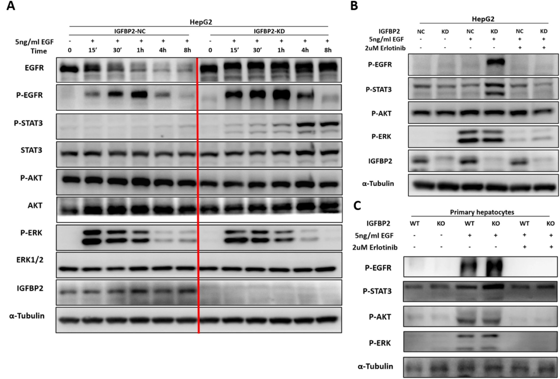 图 4：IGFBP2 缺失激活 EGFR-STAT3 通路
