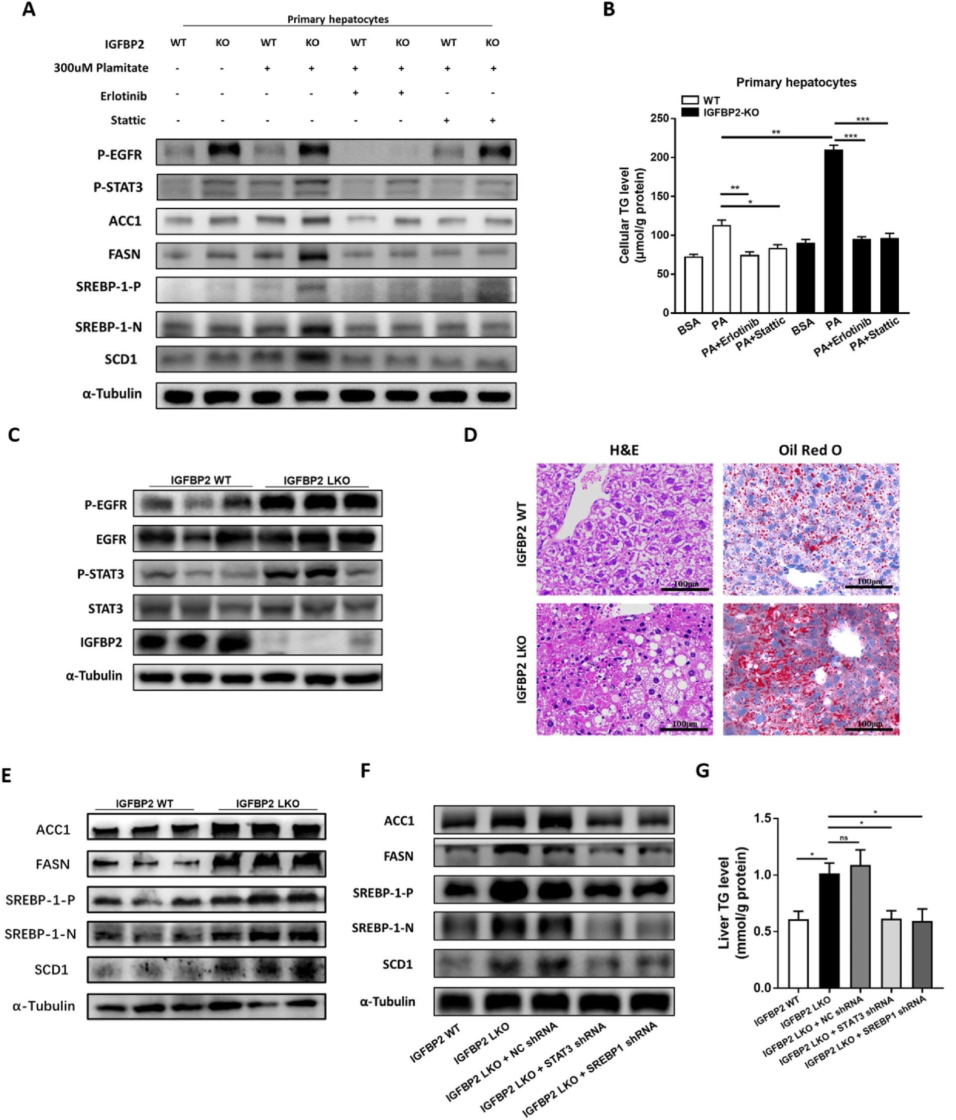 图 6：EGFR-STAT3 通路介导 IGFBP2 的抗脂肪变性作用