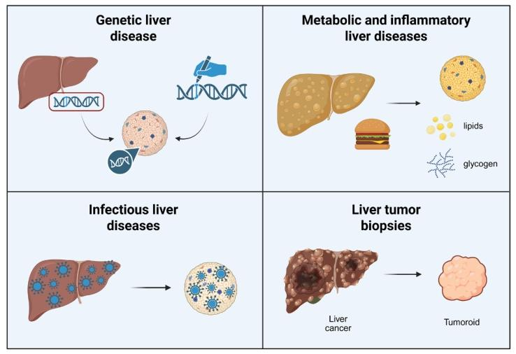 图 3：肝脏类器官用于疾病建模的示意图