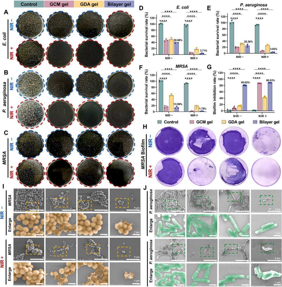 图4. 体外抗菌效能