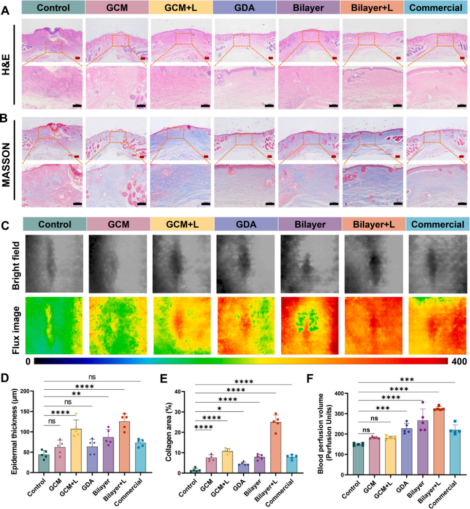 图7. 组织学分析与皮下血流灌注