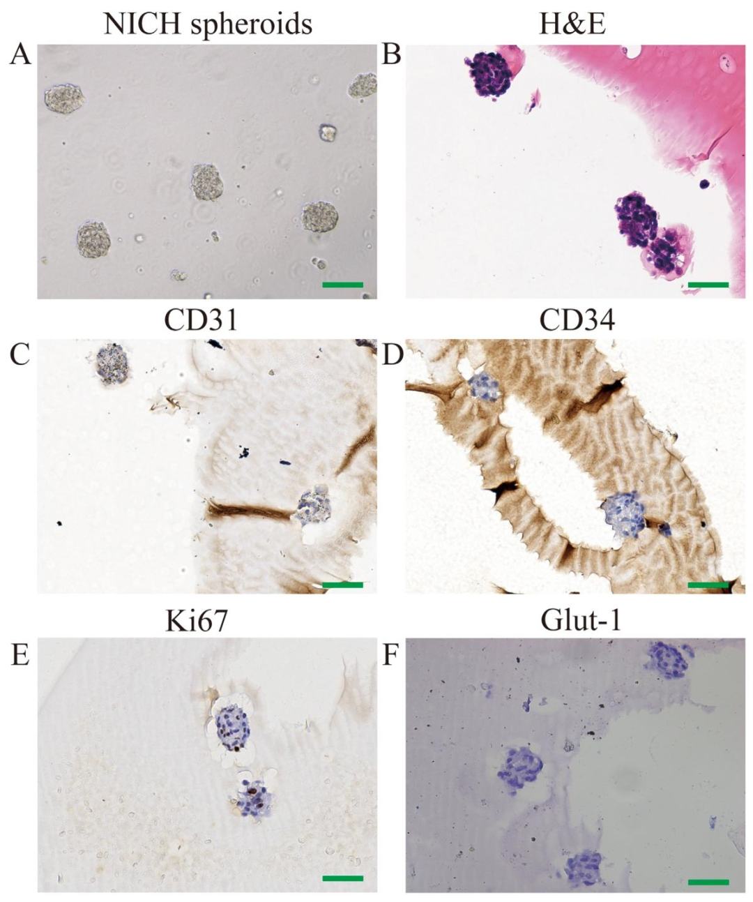 图2：CD31+NICHECs 的鉴定(球状体模型)