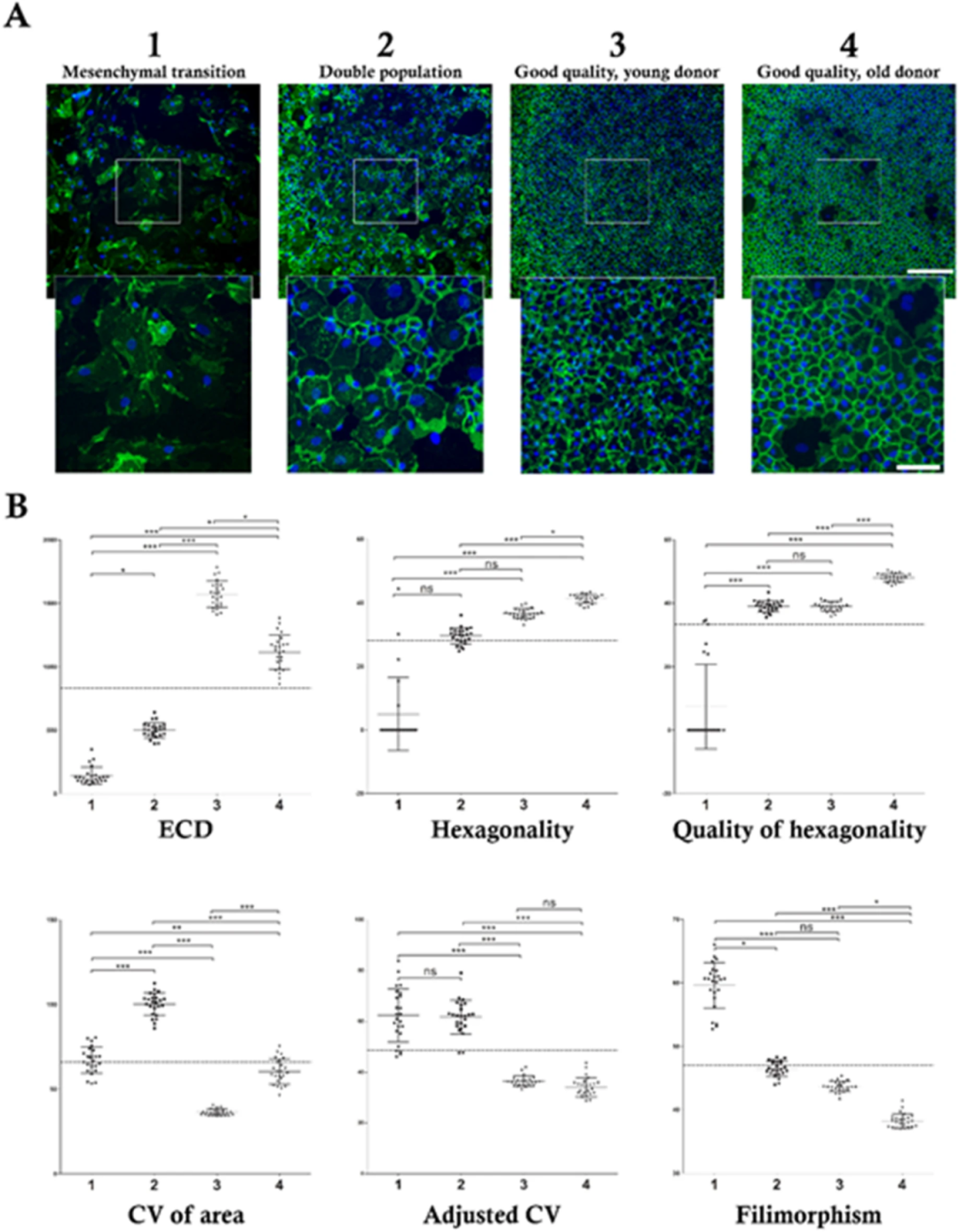 图3：AI 方法对不同质量 hCECs 培养的区分能力