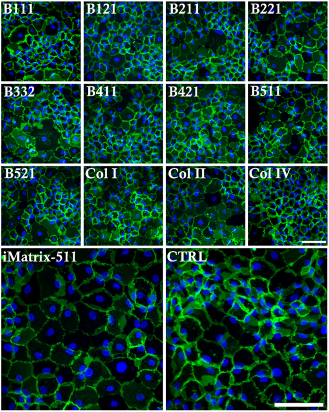 图5：不同分子涂层对 hCECs 形态的影响