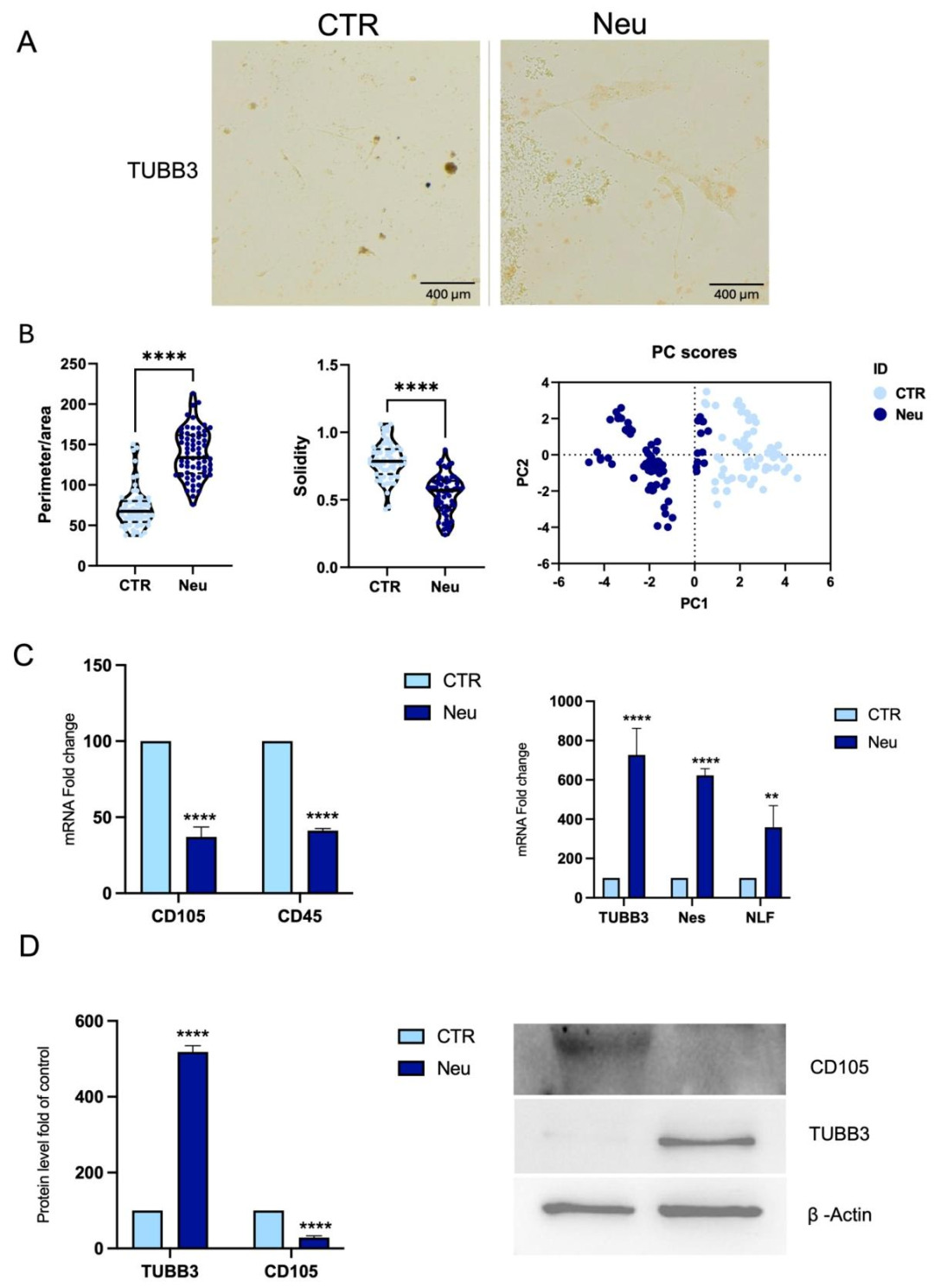 图6：CPCs 的神经样细胞分化