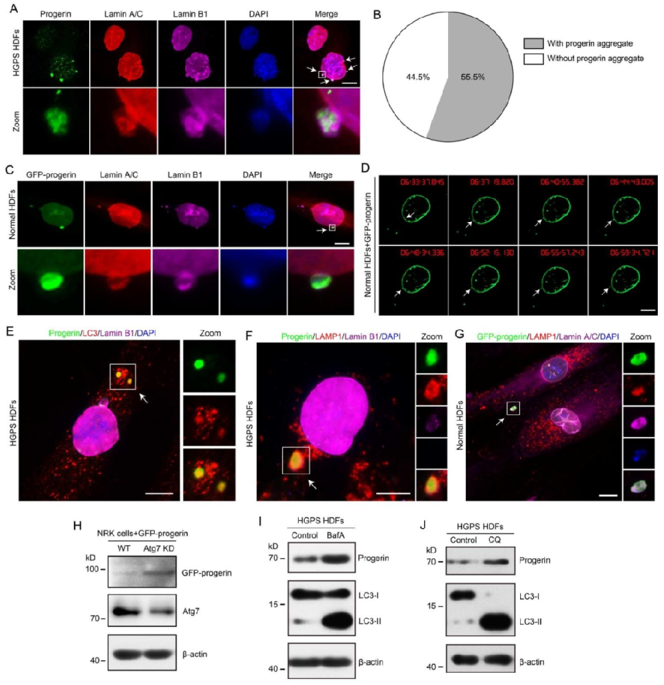图1：progerin 通过核膜出芽进入细胞质并依赖自噬 - 溶酶体降解
