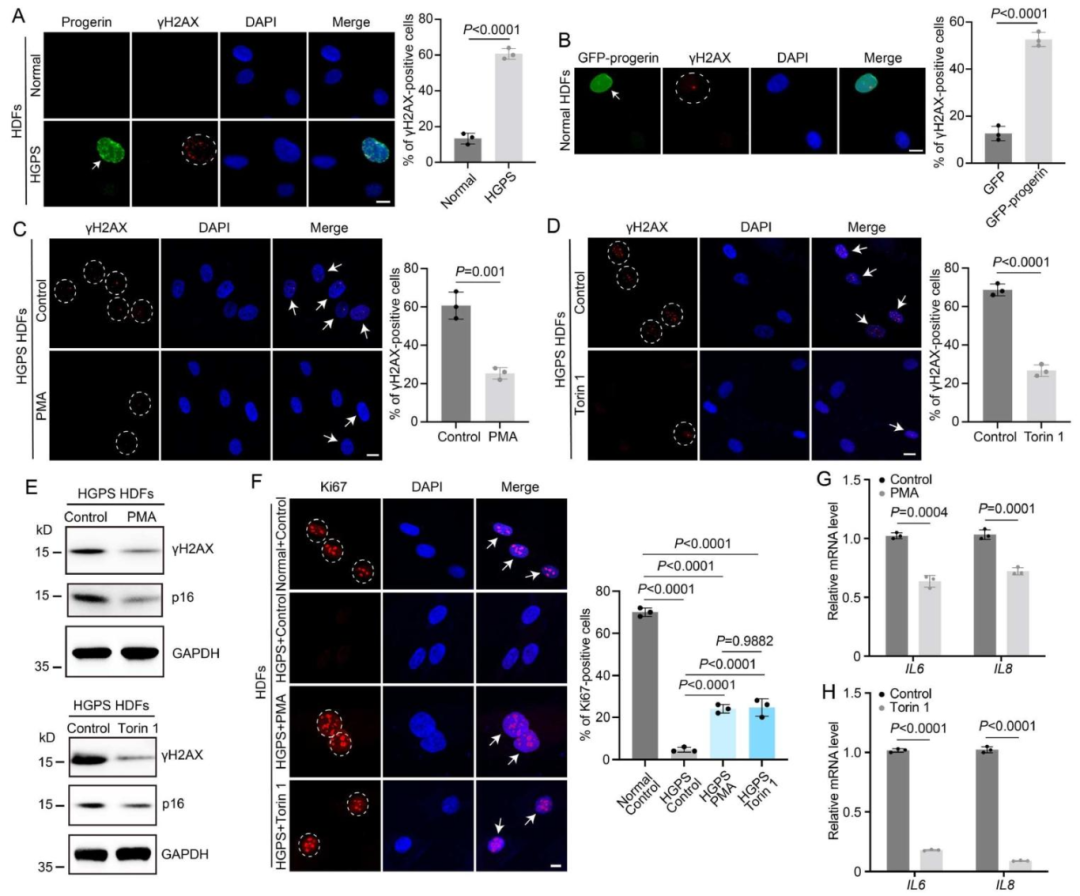 图5：激活溶酶体生成缓解 HGPS 细胞衰老表型