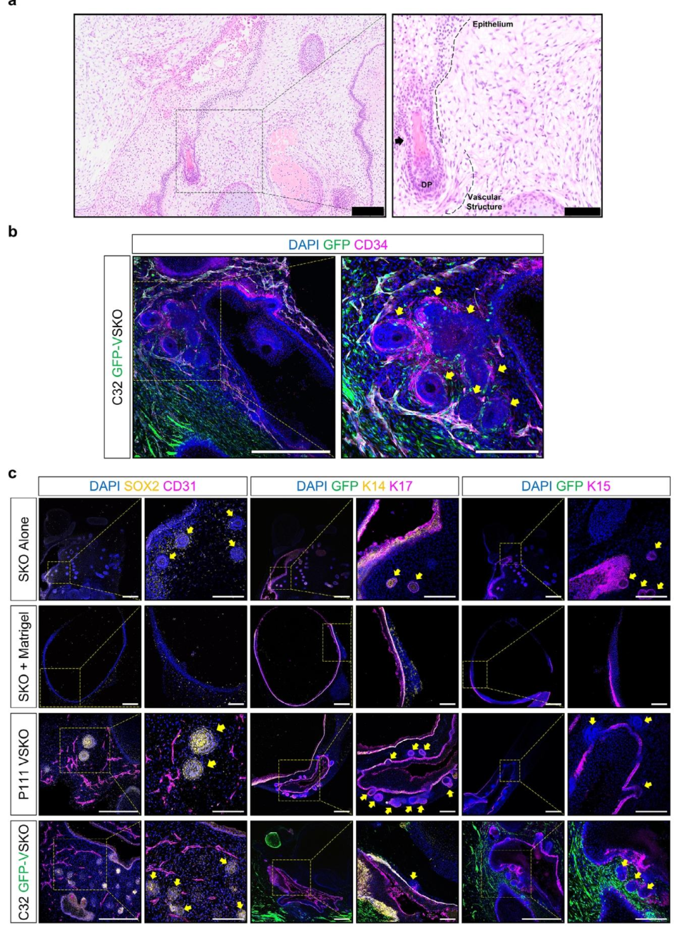 图 7：VSKO 的毛囊与血管互作