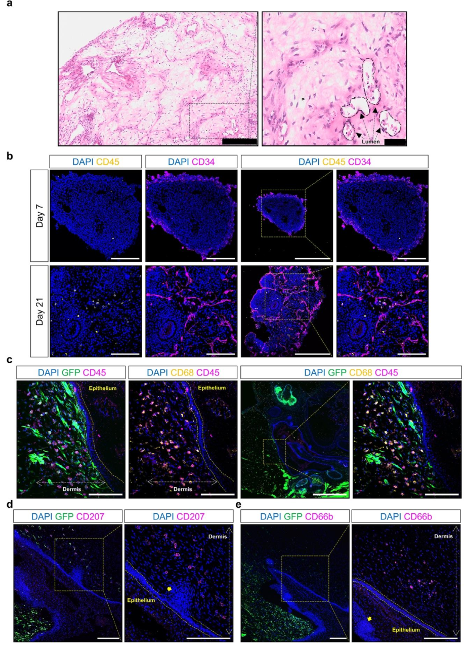 图 8：VSKO 中的免疫细胞迁移