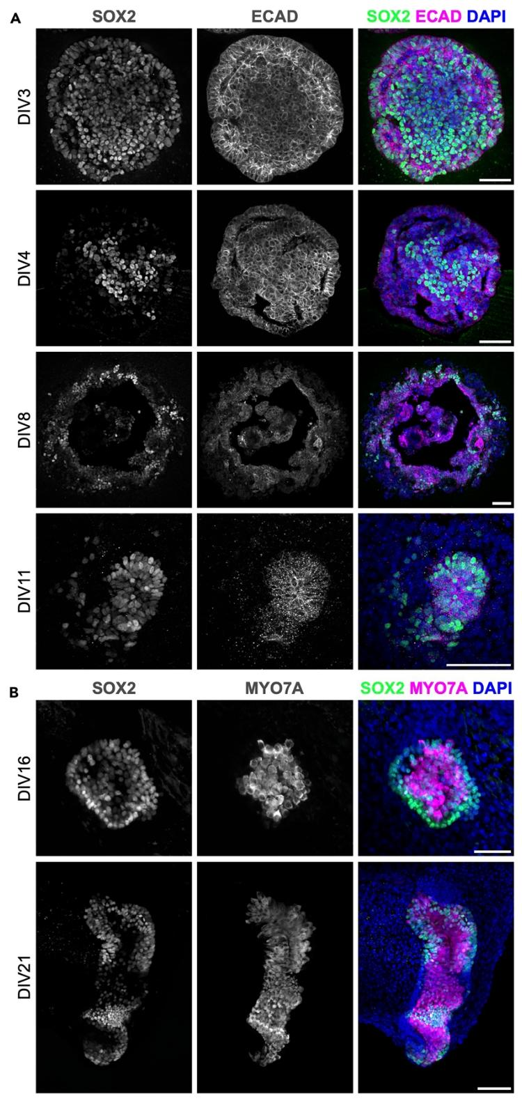 图 3：振动切片的内耳类器官免疫荧光结果
