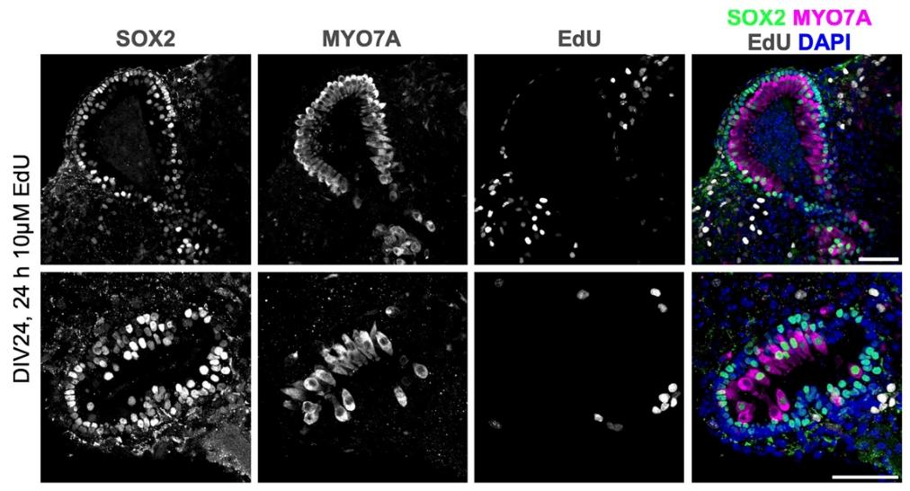 图 4：EdU 标记与免疫荧光的共定位分析