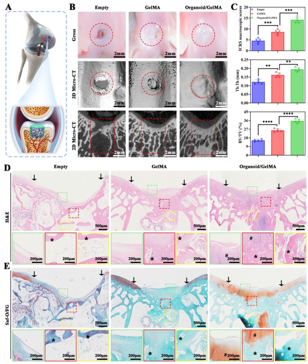 图 6:兔 OCD 模型的梯度骨软骨再生