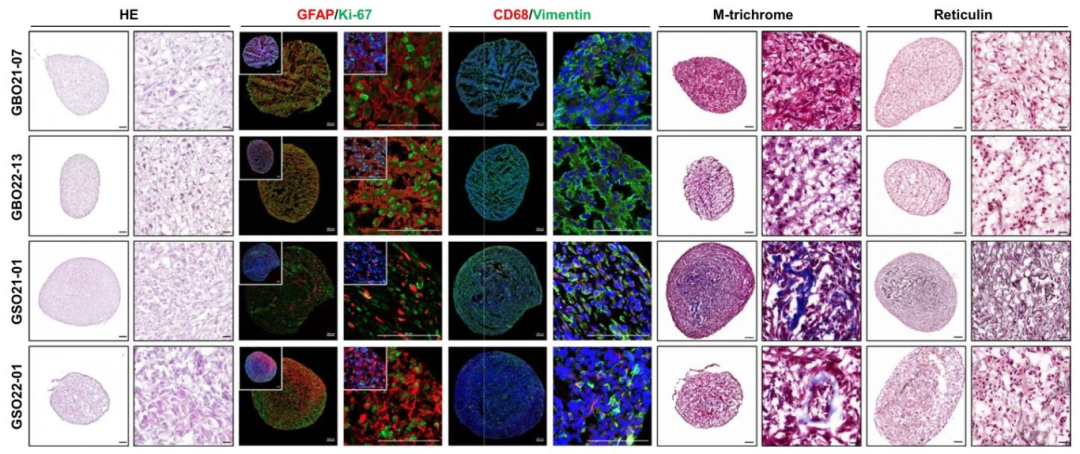 图 4：GSOs 与 GBOs 的组织学差异