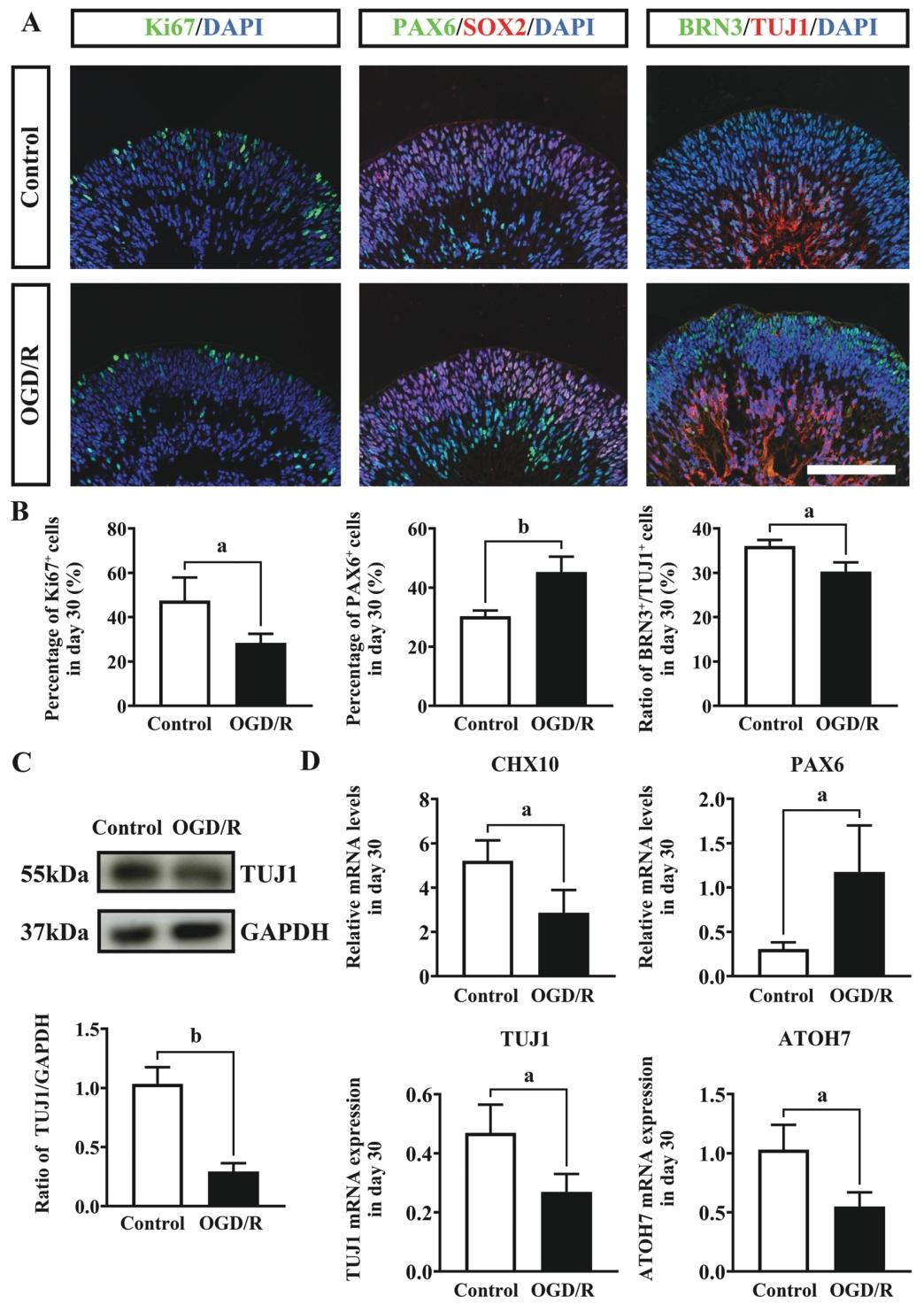 图 4：第 30 天 OGD/R 处理对视网膜发育的影响