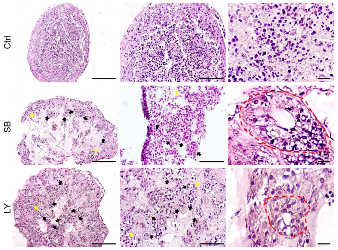 图 2：TGF-β 抑制对管状结构重建的影响
