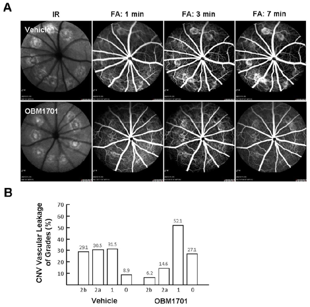 图1：OBM1701 减轻大鼠激光诱导 CNV 的血管渗漏