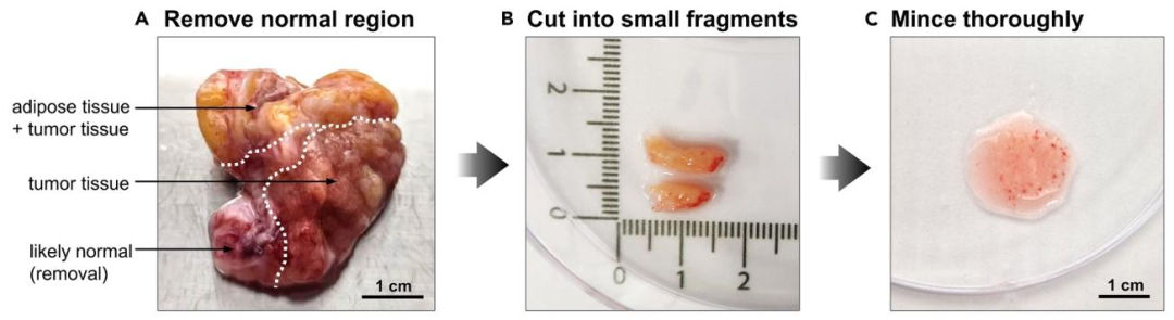 图 2:手术组织标本处理步骤