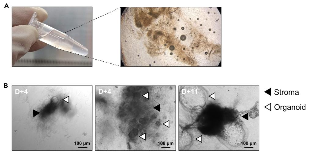 图 3:PDO 在基质中的生长景观