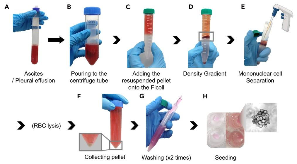 图 5:液体活检标本的肿瘤细胞分离流程