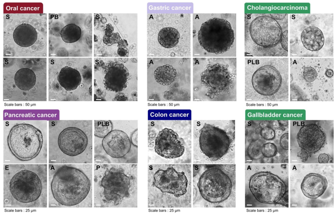 图 12:不同癌症 PDO 的形态差异