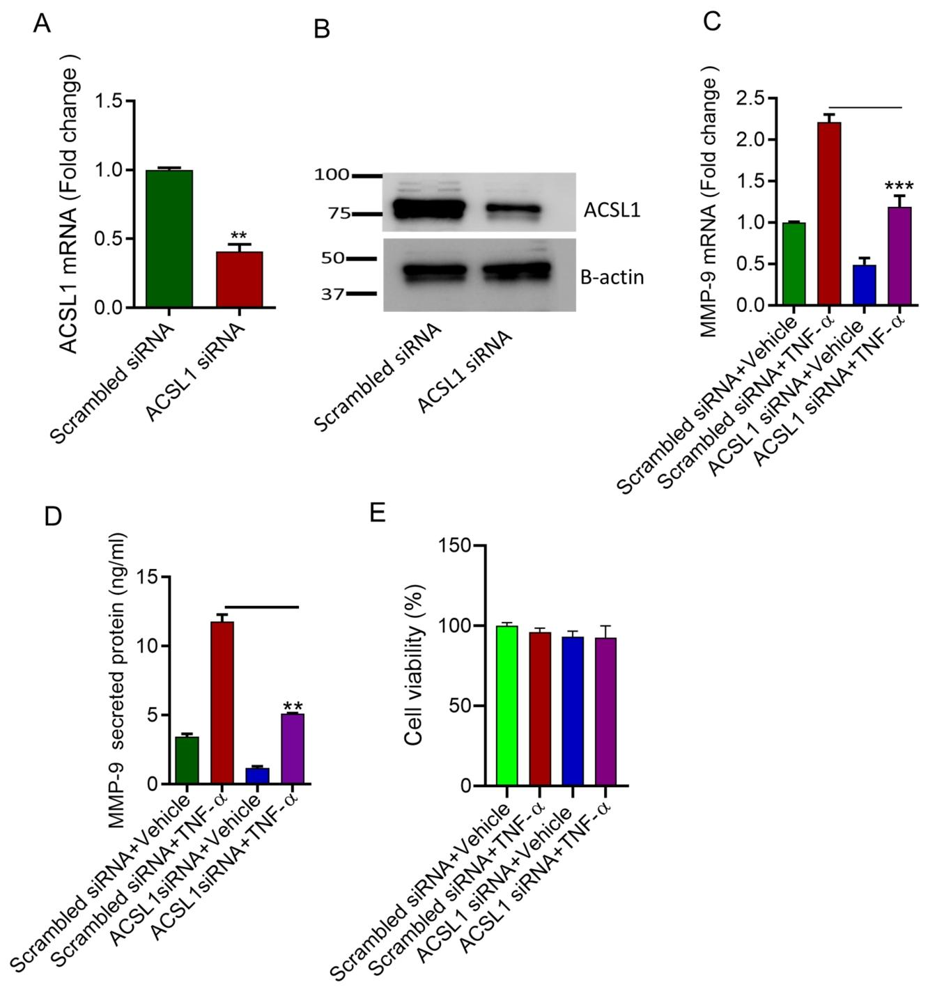 图 3:ACSL1 siRNA 敲低抑制 TNFα 介导的 MMP-9 产生