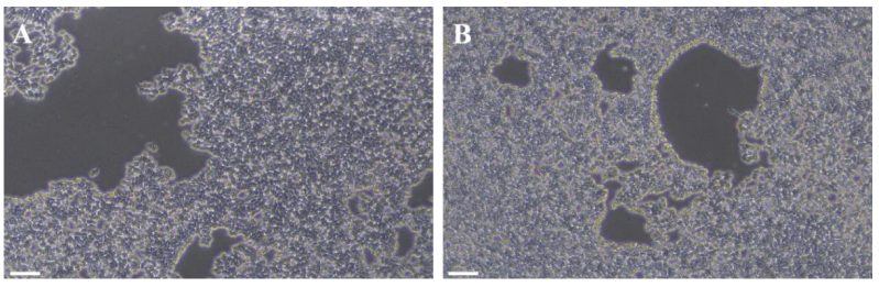 图 2：消化 hiPSC 细胞不同时间形态图