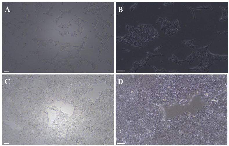 图 1. hESC/iPSC完全培养基连续培养hiPSC细胞形态图