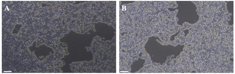 图 2：消化 hESC(H1)细胞不同时间形态图