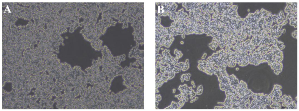 图 2：消化 hESC 细胞不同时间形态图