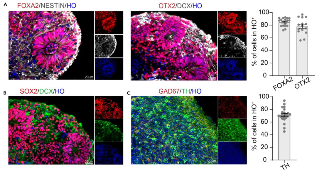 图 3：中脑类器官不同阶段的免疫荧光验证