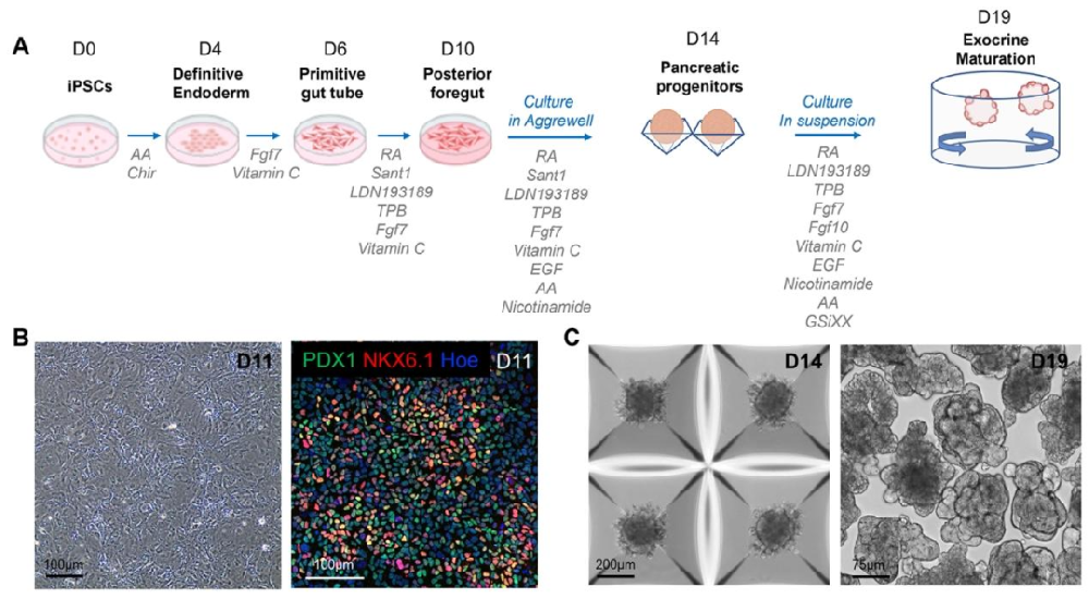 图 1：hiPSC 分化为胰腺类器官的流程与祖细胞验证