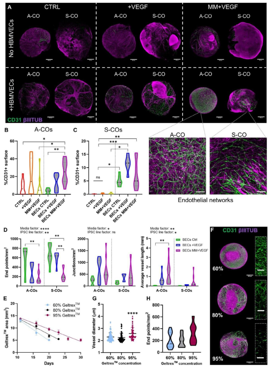 图 4：类器官表面内皮网络的形态差异