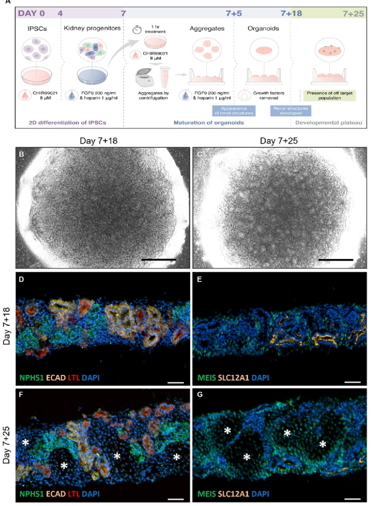 图 1:肾类器官培养流程与异位细胞出现