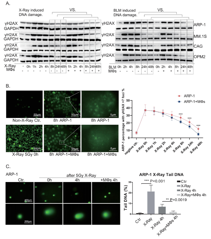 图1：MΦs 体外促进 MM 细胞 DSB 修复