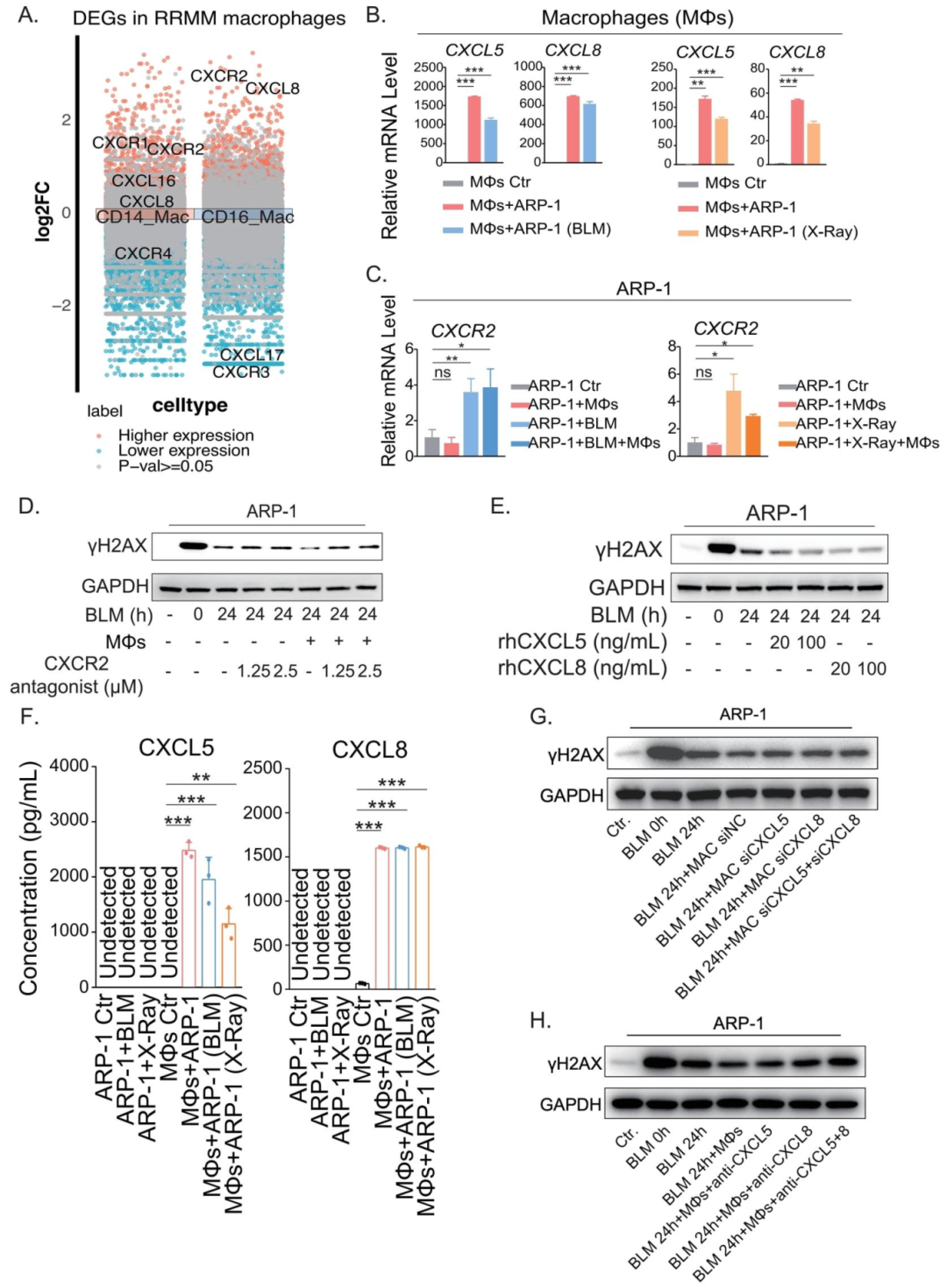 图3：CXCL5/8-CXCR2 轴介导 MΦs 对 MM 细胞 DNA 修复的促进作用