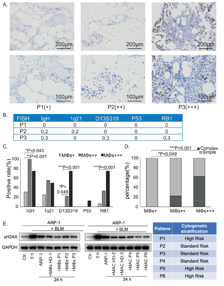 图8：MM 患者骨髓 MΦs 含量与核型复杂性正相关