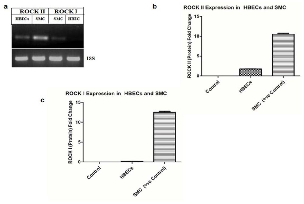 图1:HBECs 中 ROCK 亚型的表达特征