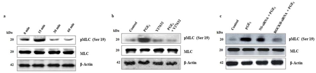 图5:PGE₂诱导 MLC 磷酸化依赖 ROCK II