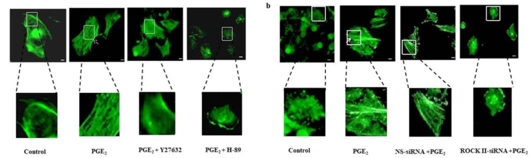 图6:PGE₂诱导 F-actin 聚合依赖 PKA-ROCK II 通路