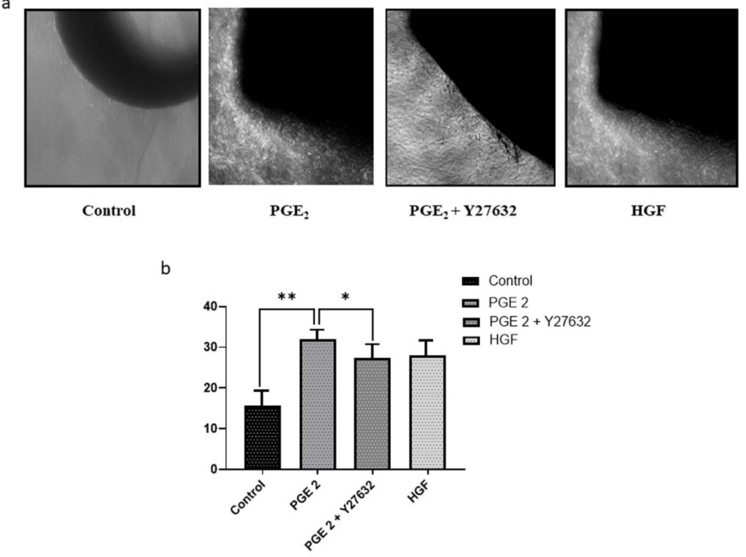 图7:PGE₂诱导血管生成依赖 ROCK II