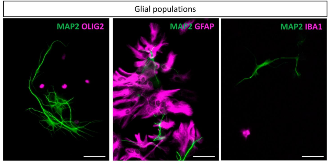 图4:后脑培养中的胶质细胞鉴定