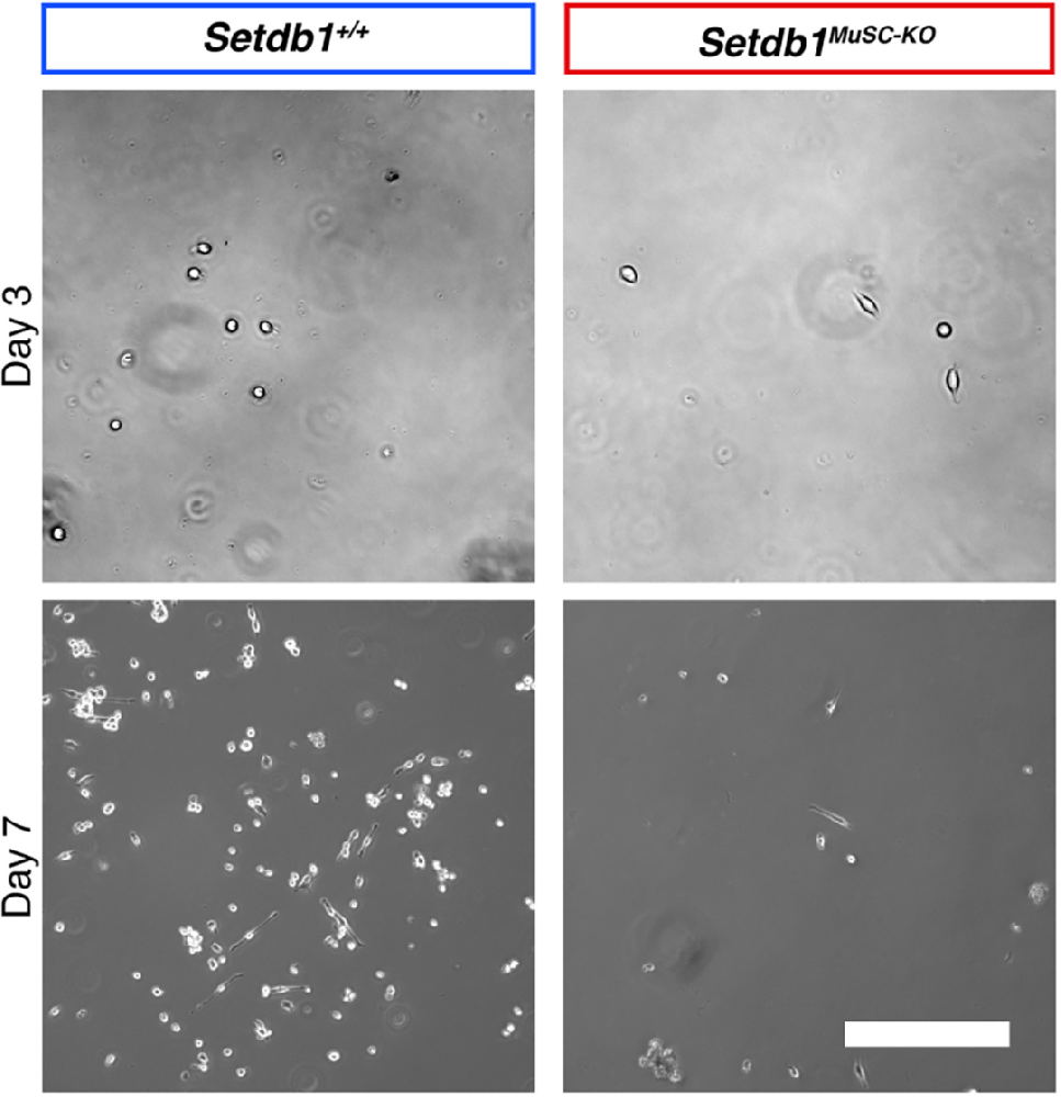 图1:MuSCs 增殖形态观察