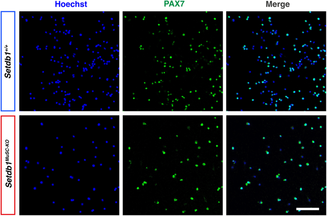 图2:PAX7 免疫染色验证 MuSCs 纯度