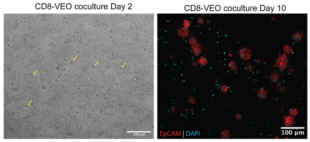 图 3：CD8 T 细胞 - VEO 共培养的形态与免疫荧光验证