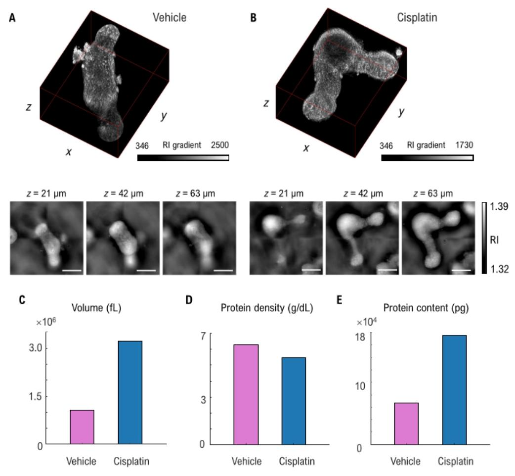 图 3：顺铂处理类器官的 3D 结构与定量分析