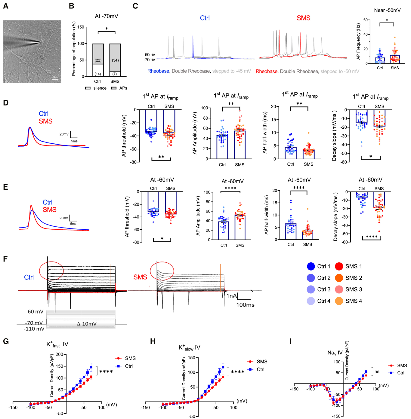 图 6：SMS 神经元的电生理异常