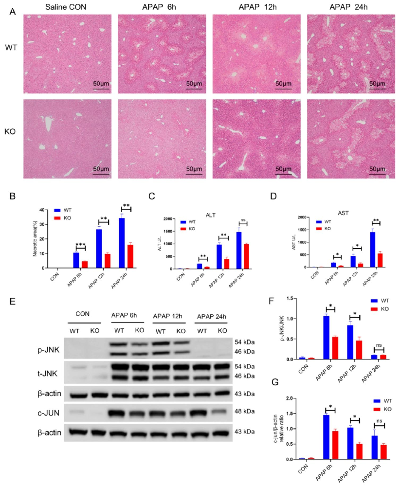 图1：NTCP KO 减轻 APAP 诱导的肝损伤