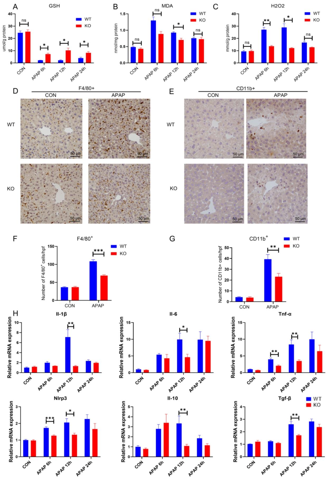 图2：NTCP KO 降低 APAP 诱导的氧化应激和炎症反应