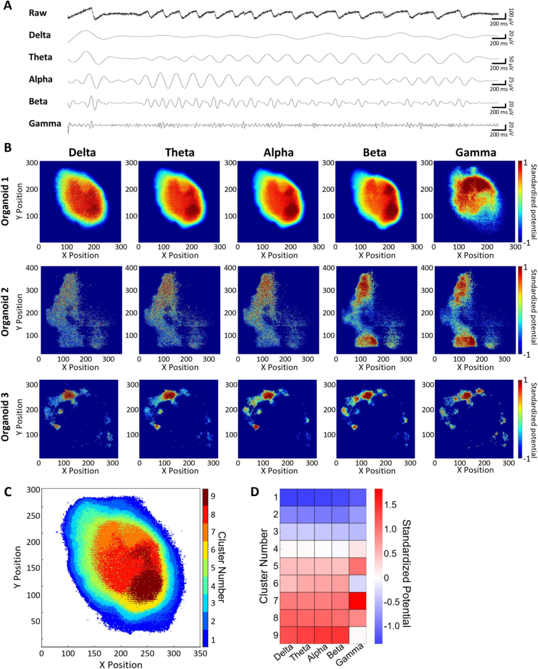 图 4:皮质类器官的频率特征分析